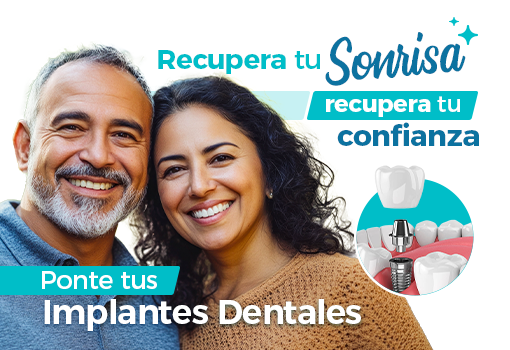 IMPLANTES DENTALES 