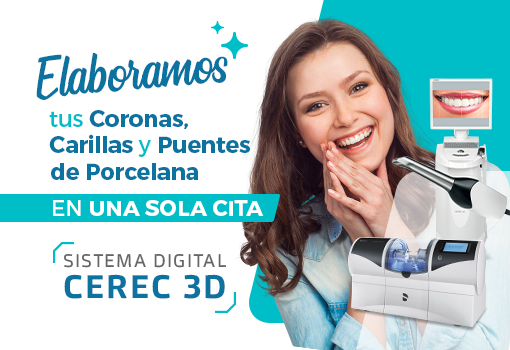 cerec