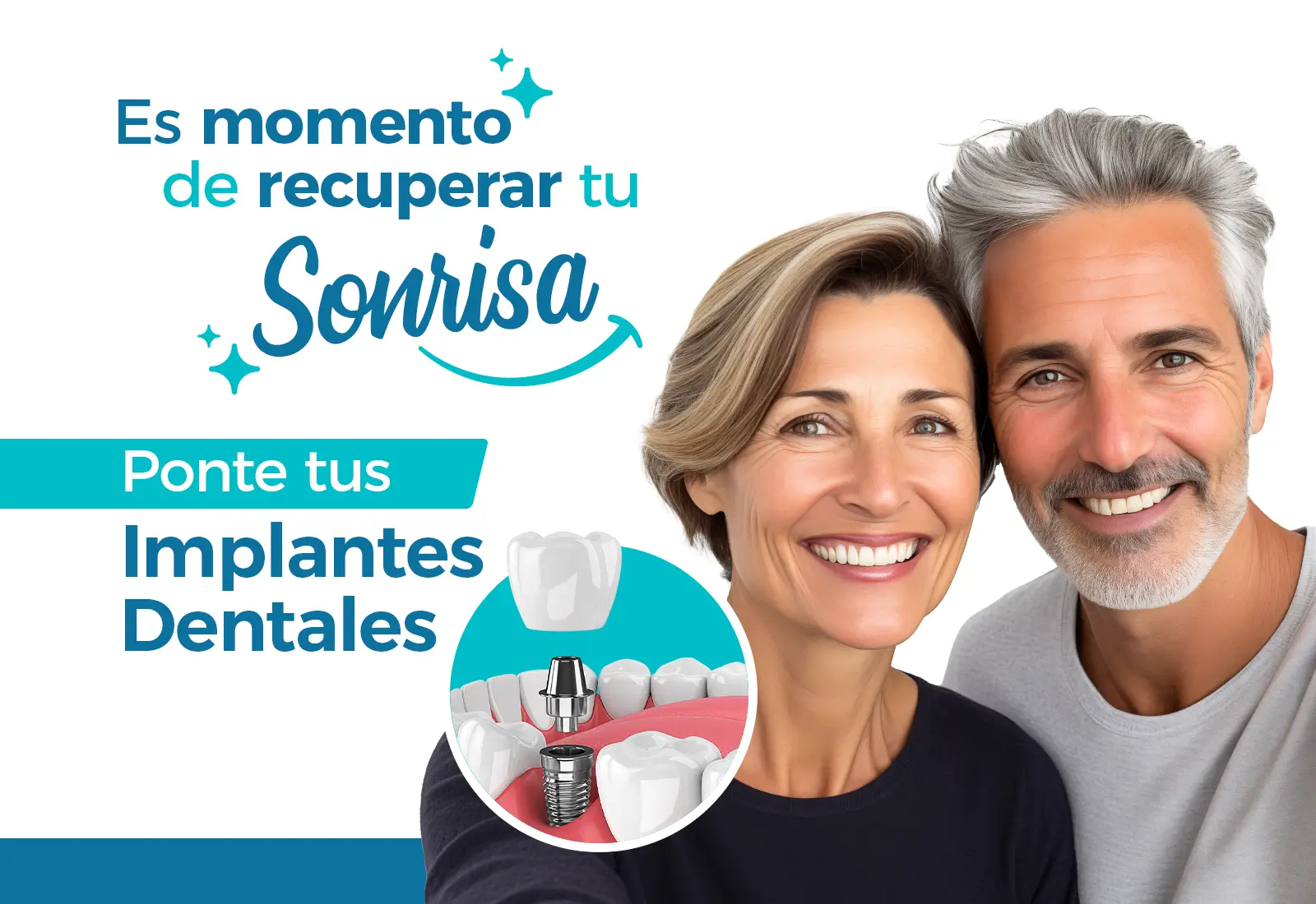 Implantes Dentales