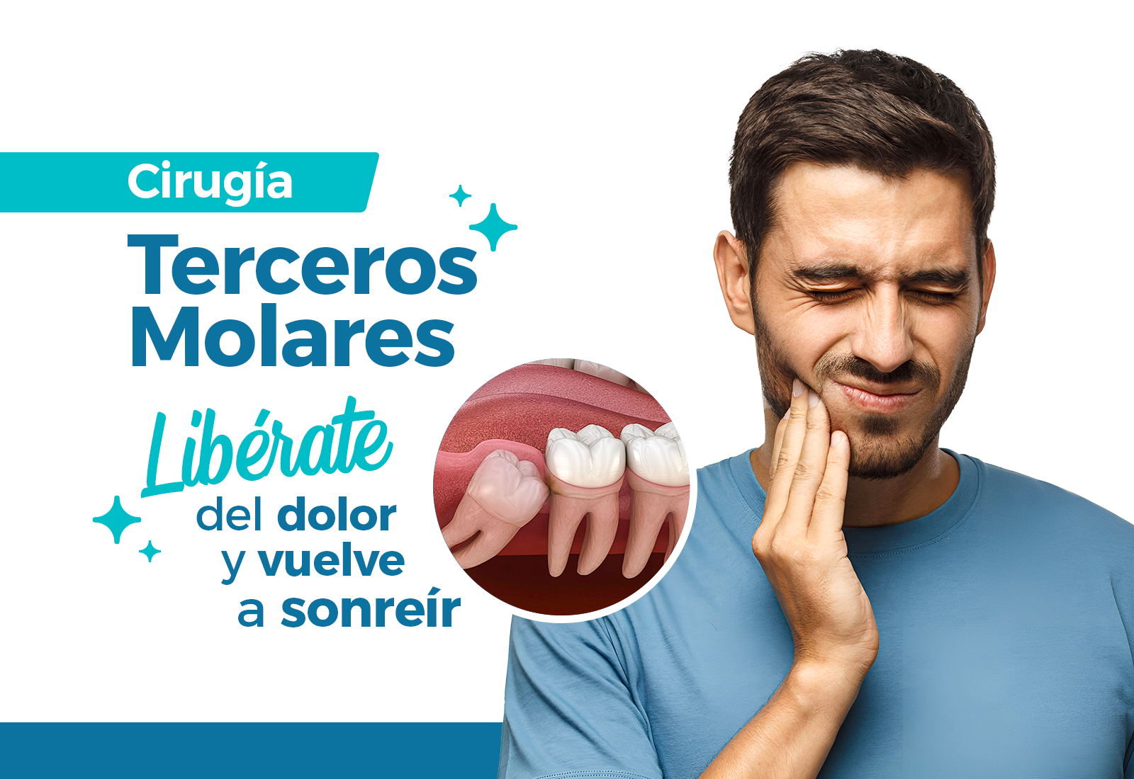 Terceros Molares